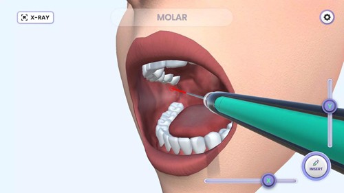 牙医模拟器Boring Game手机中文版截图1