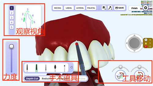 牙医模拟器中文版新手攻略3
